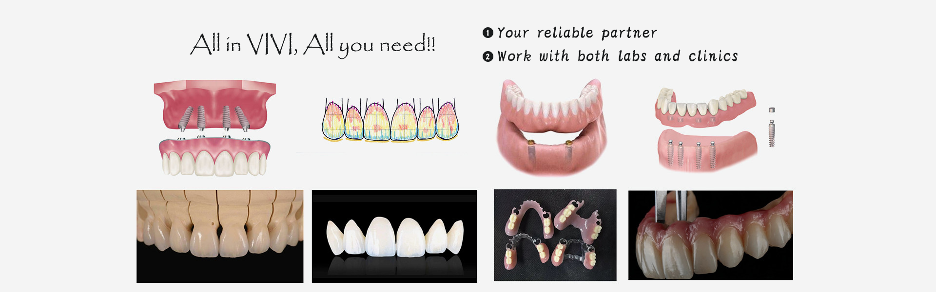 Qualità Laboratorio dentistico cinese Fabbrica