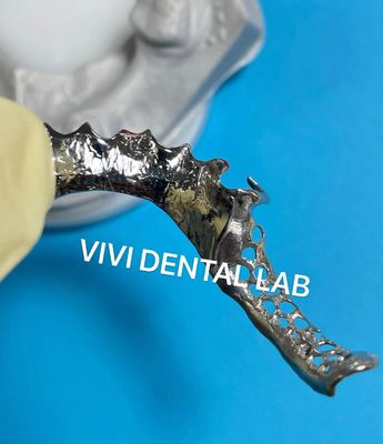 Quadro parziale di metallo SLM Ni Be libero laboratorio dentale cinese