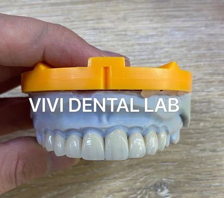 Il laminato di Ivoclar Emax impiallaccia il laboratorio dentario ad alto livello professionale traslucido della Cina