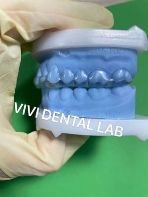 Stabile Michigan Splint Splint dentale con perfetta vestibilità e qualità professionale