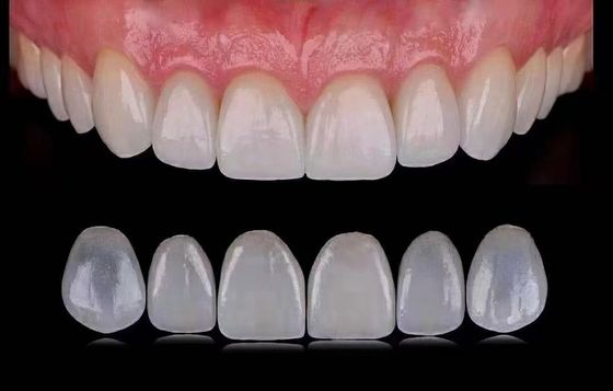 Finiture dentali laminate Emax trasparenti / finiture dentali in porcellana ISO approvate
