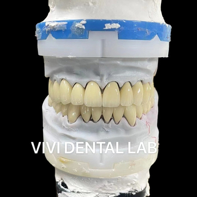 Corone di laboratorio dentale digitale CAD CAM Corone di zirconia a strati traslucida