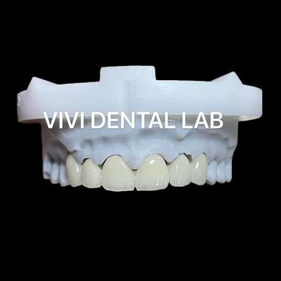 Corona di zirconia dentale a strati e ponte traslucidità 3D PRO