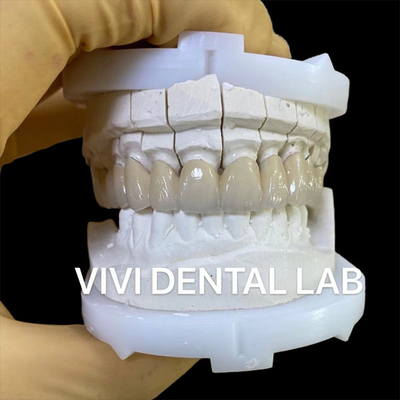 Corone dentali di laboratorio di precisione corone estetica di porcellana di zirconia