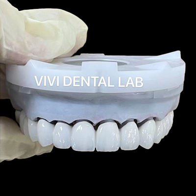 Corone di laboratorio dentali in zirconia super bianca 3D PRO PFZ Noritake porcellana