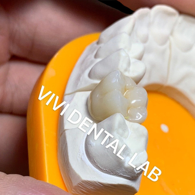 Il laboratorio dentario solido corona la pro alta traslucidità che 3D il biossido di zirconio pieno incorona il laboratorio dentario della Cina