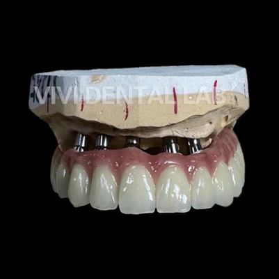 Laboratorio dentario della Cina del ponte totale dell'impianto PFM