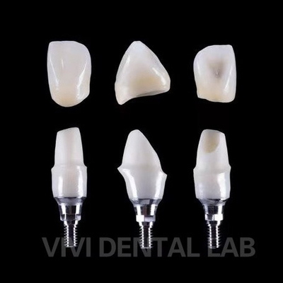 Impianto dentale Tibase Abutment di zirconia Titanio Precisione personalizzata