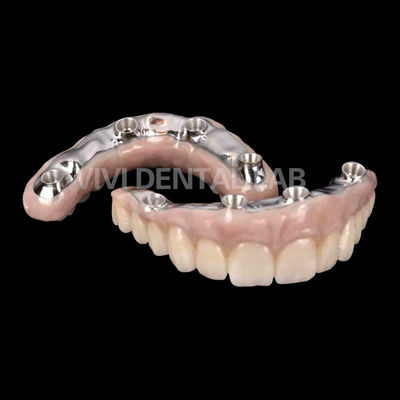 Corona di impianto dentale in zirconia biocompatibile con barra di titanio