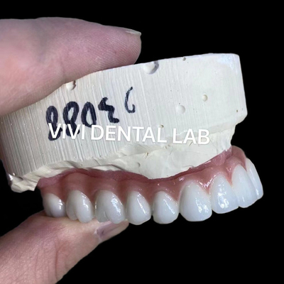 Naturale aspetto estetico vite trattenuta zirconia impianto corona duratura