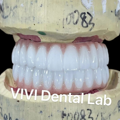 Ni Be Free Zirconia Dental Implant Bridge On Bar Alta estetica