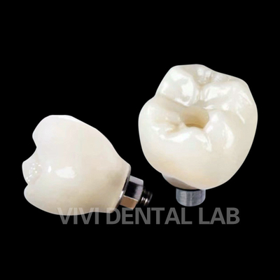 Croce di impianto dentale a vite PFZ in porcellana stratificata in zirconia