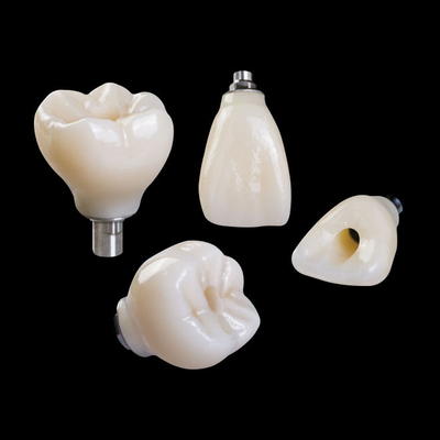 Impianto dentale circonico professionale corona di titanio CAD CAM