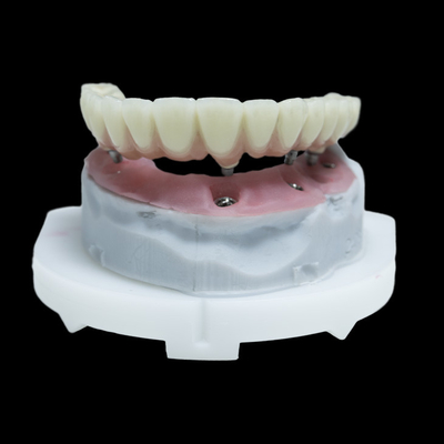 Tutti su 4 PFM Impianto dentale corona di titanio zirconia Tutti su 6 restauri
