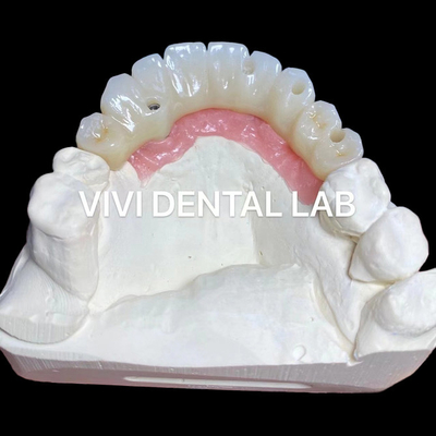 Accuratezza PMMA Full Zirconia Bridge Over Multi Unit Abutments