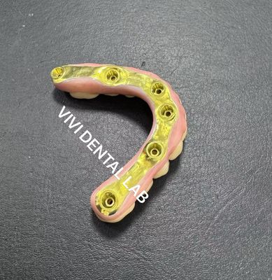 Ponte di zirconia completa con supporto per barre di titanio laboratorio dentale cinese