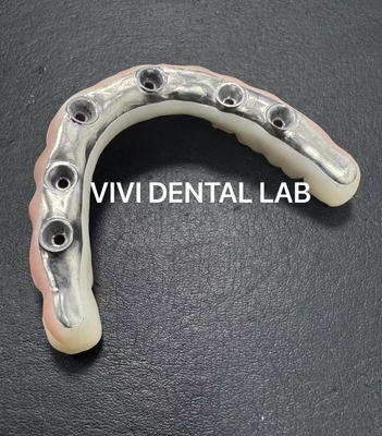 La CINA VIVI DENTAI LABORATORY Certificazioni