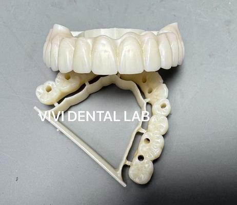 ponte totale in zirconia avvitata laboratorio odontotecnico cinese