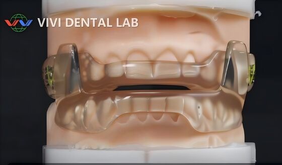 Dispositivo per russare dorsale di laboratorio dentale in Cina