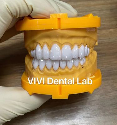 Il laminato di Ivoclar Emax impiallaccia il laboratorio dentario della Cina dell'alta traslucidità