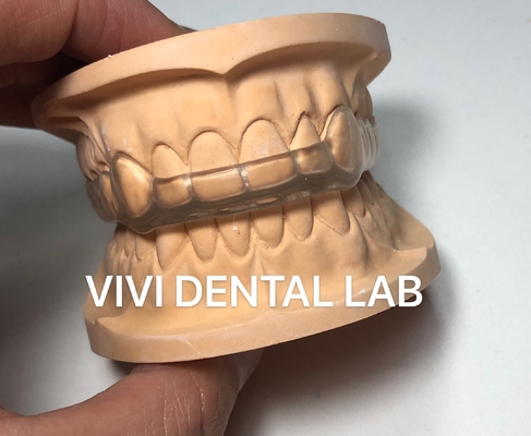Night Dental Mouth Guard Oclusal Splint Ekodent Buona vestibilità Alta estetica