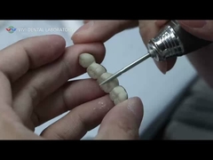 Ponte metallica ceramica