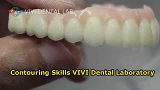 Competenze nel modellamento della forma VIVI Dental Laboratory Cina
