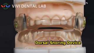 Dispositivo dentale antirussamento
