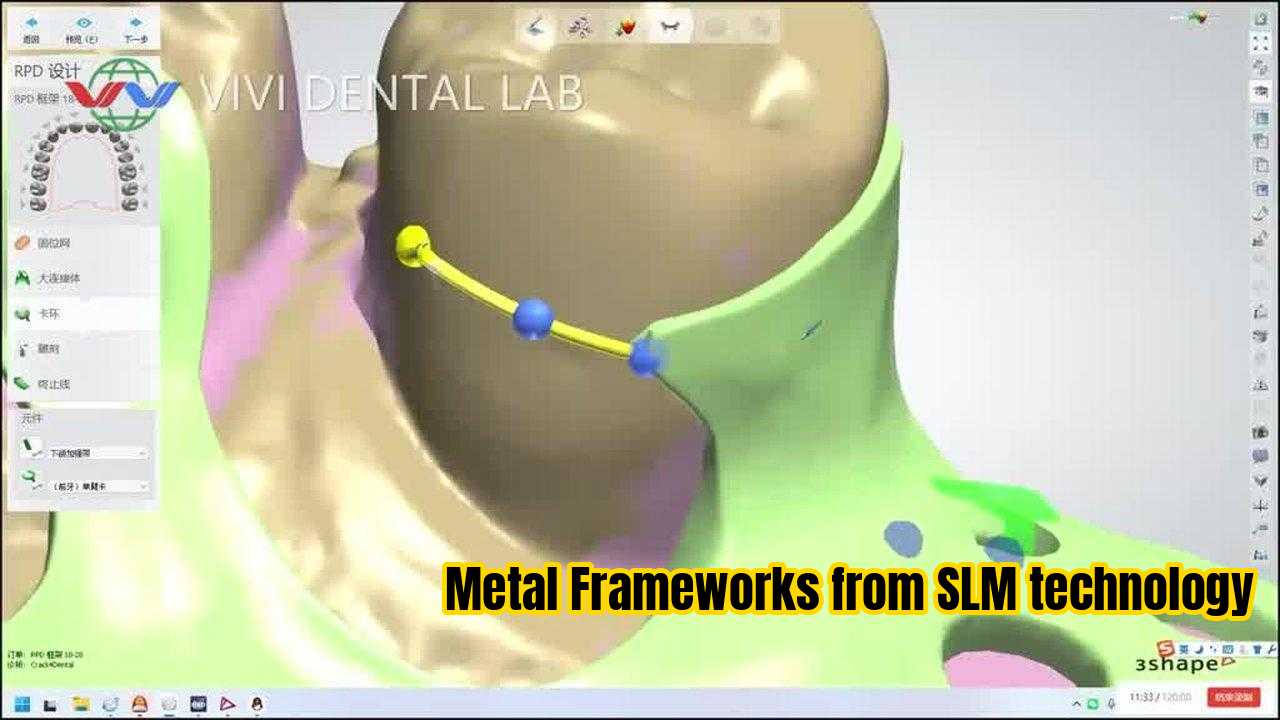 La CINA VIVI DENTAI LABORATORY Certificazioni