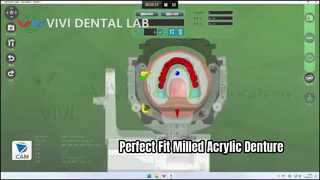 Protesi fresata in acrilico Superior Fit Digital
