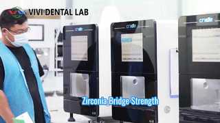 Ponte in zirconio Estetica forte VIVI Dental Lab